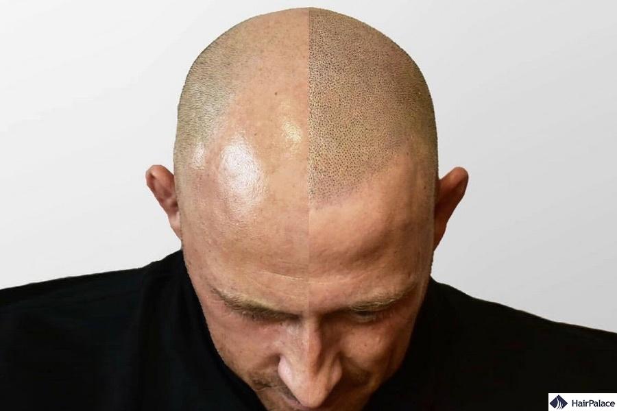 hair tattoo for men