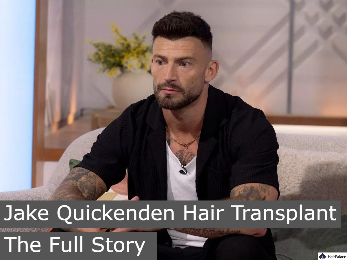 jake quickenden hair transplant the full story