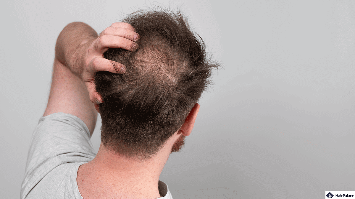 how to use glycolic acid on scalp