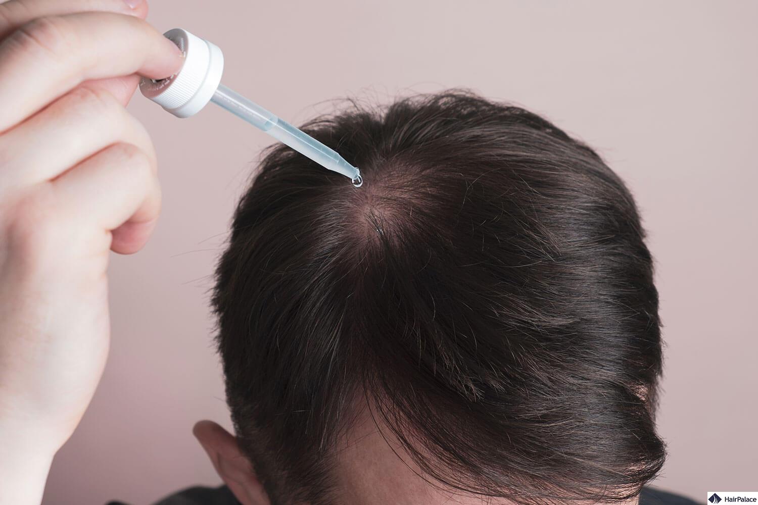 Minoxidil 10 percent is this the best dosage